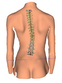 3-D Wirbelsäulenvermessung